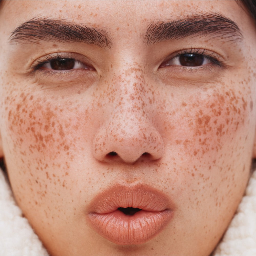 A model with freckled skin stares straight at the camera to show her moisturized face.